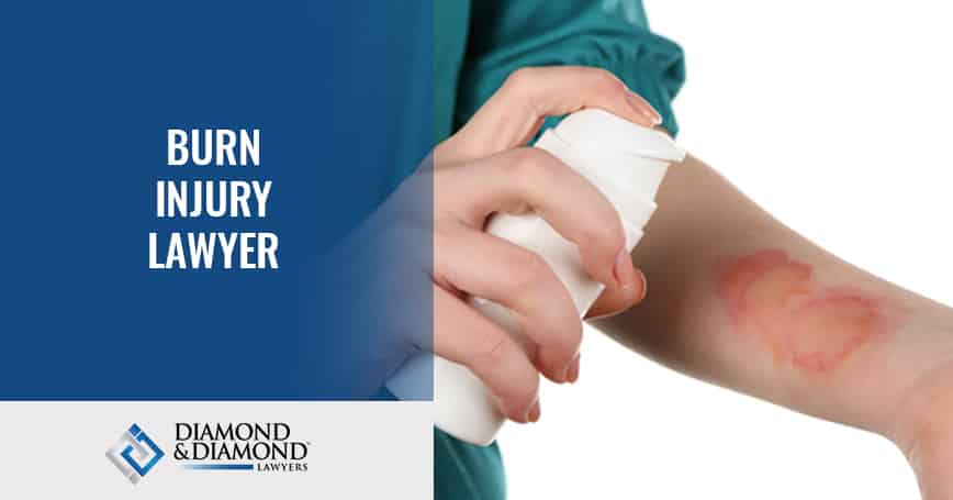 Burn Injury Lawyer