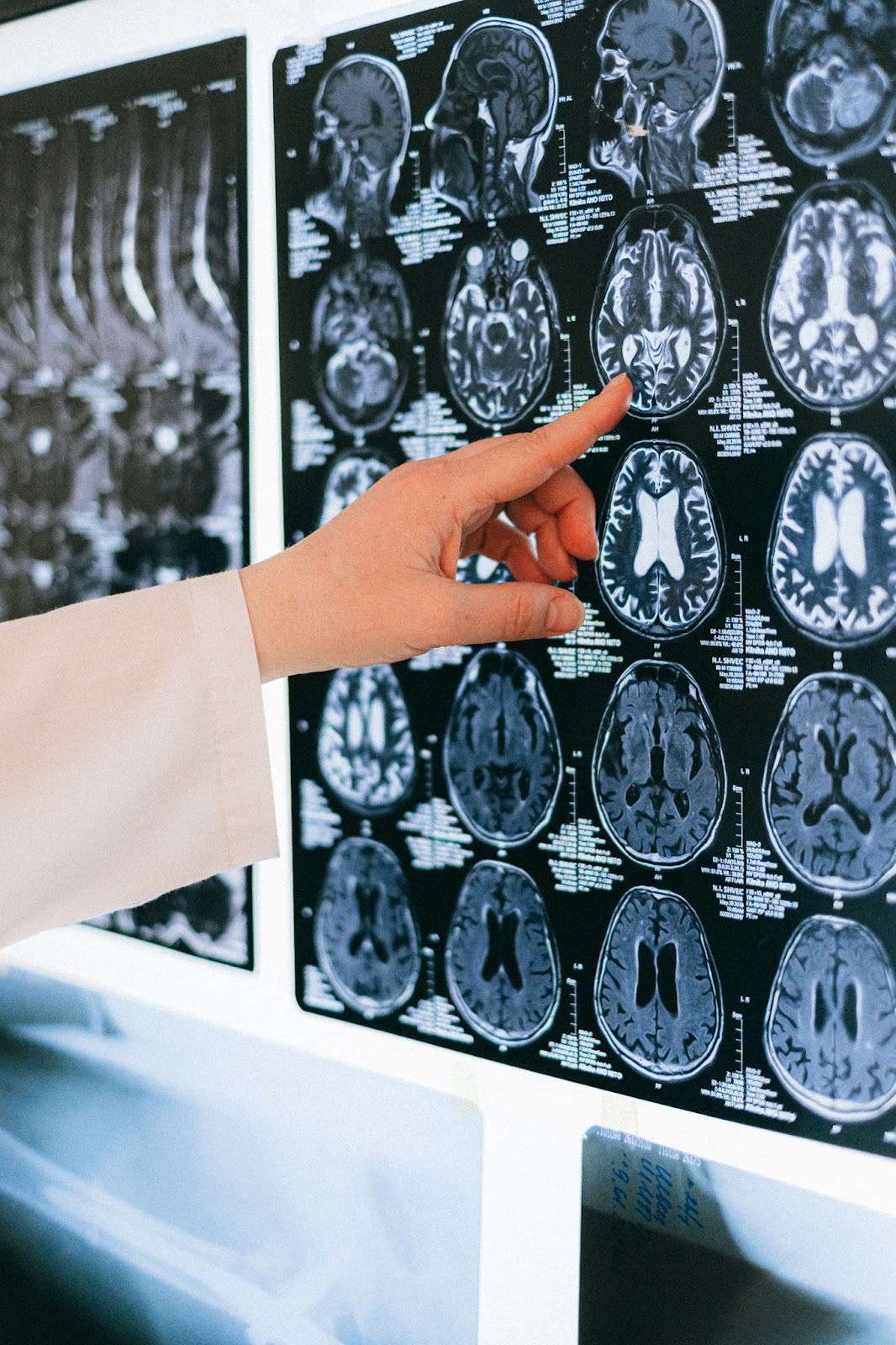 Concussion Injury Lawyer